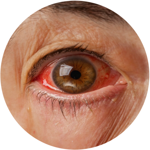 medical eye exams houston